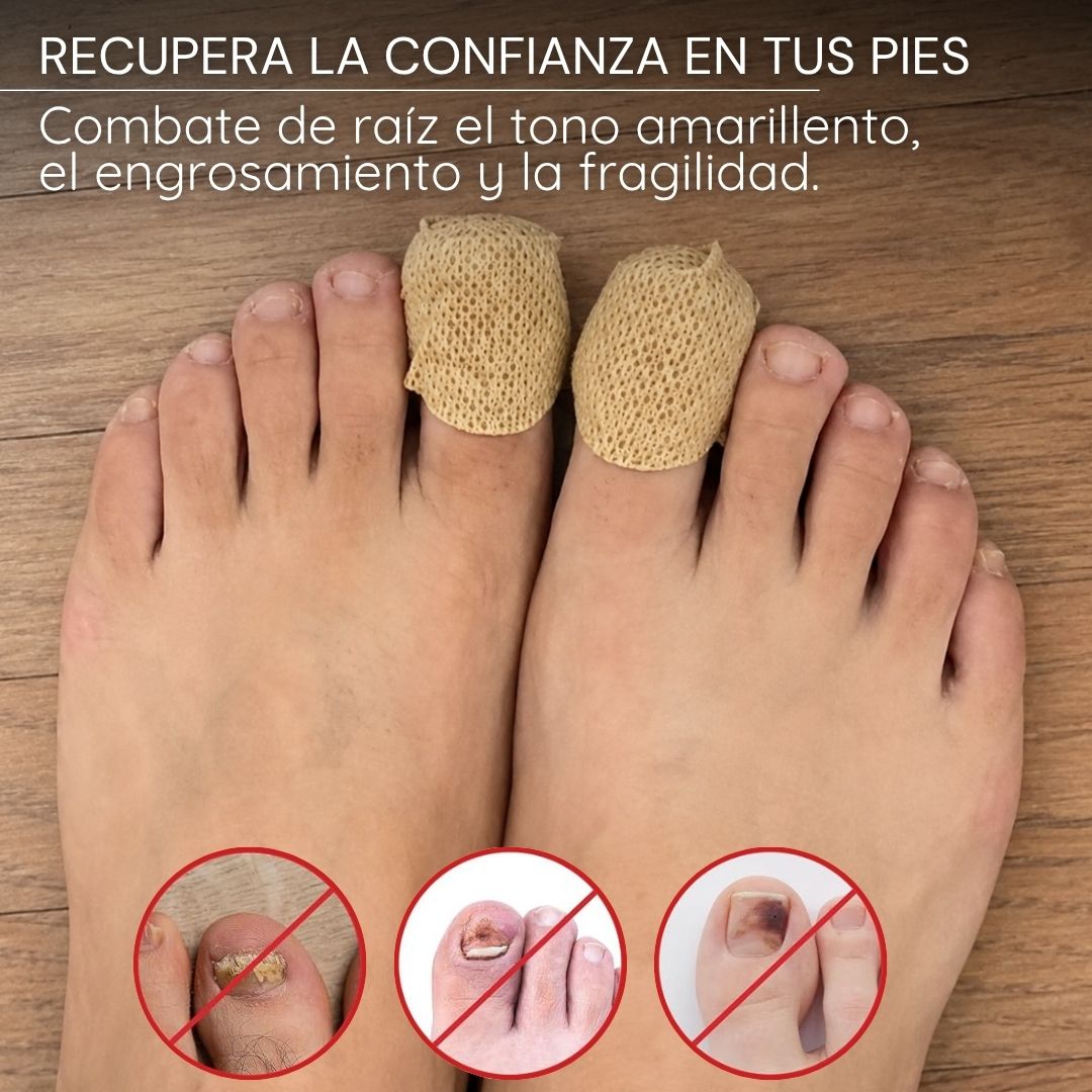 Parches anti hongos